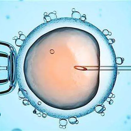 乌克兰试管婴儿